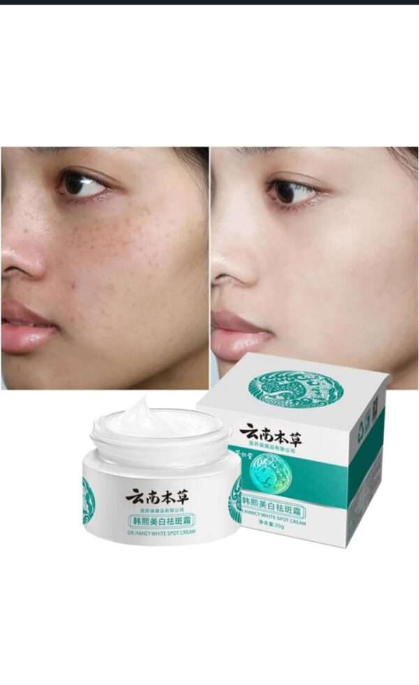 Dr. Hancy white spot cream