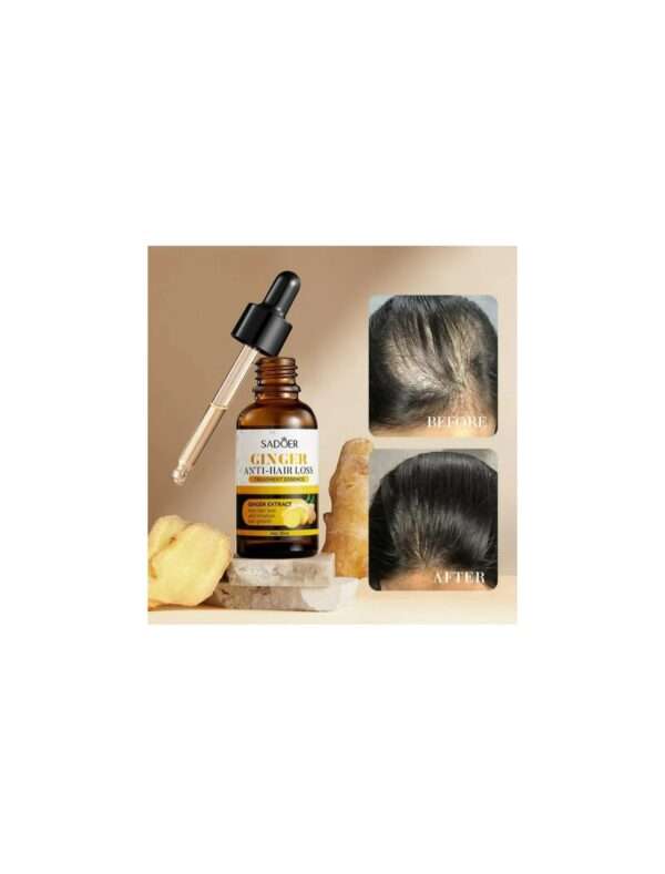 Sadoer ginger anti - hair loss treatment essence oil - Image 4